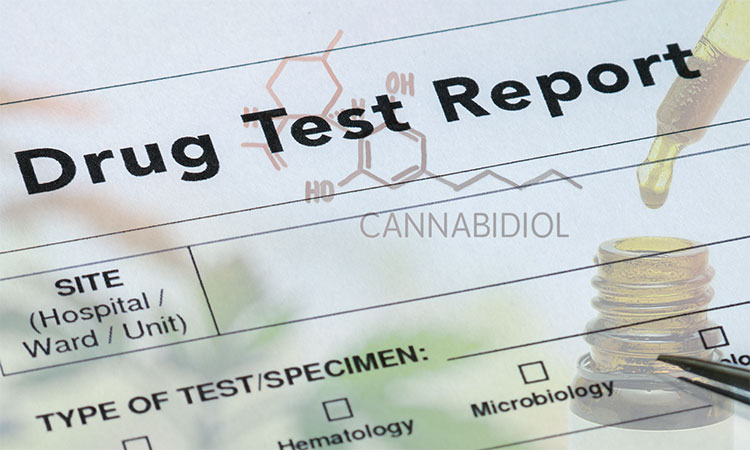Will CBD show up on a drug test?
